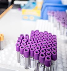 Læknisráð - Skimanir