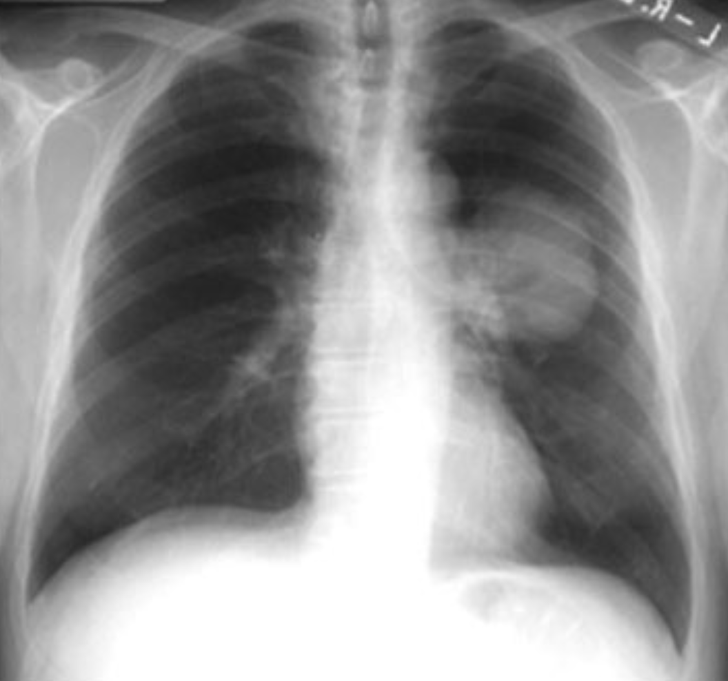 Samkeppniseftirlitið ógildir samruna myndgreiningafyrirtækja