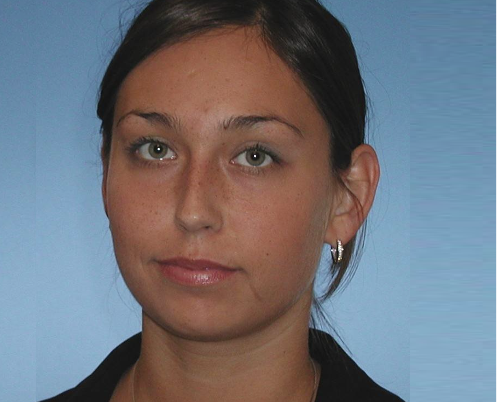 Samtök yfirlækna vilja óháða úttekt á legskimunum úr landi