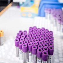 Læknisráð - Skimanir